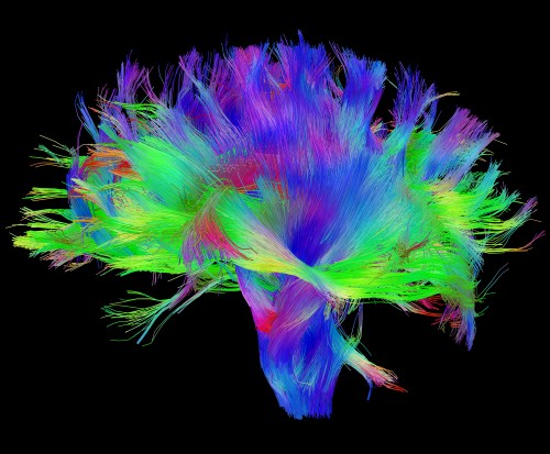 Diffusion MRI scan of the brain